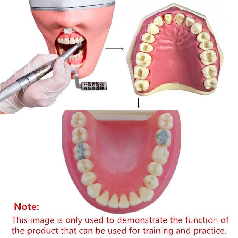 Dental Tanden Model Voor Tandheelkundige Technicus Praktijk Training Studyting Tandheelkunde Typodont Modellen Met Verwisselbare Tooth Voor Nissin