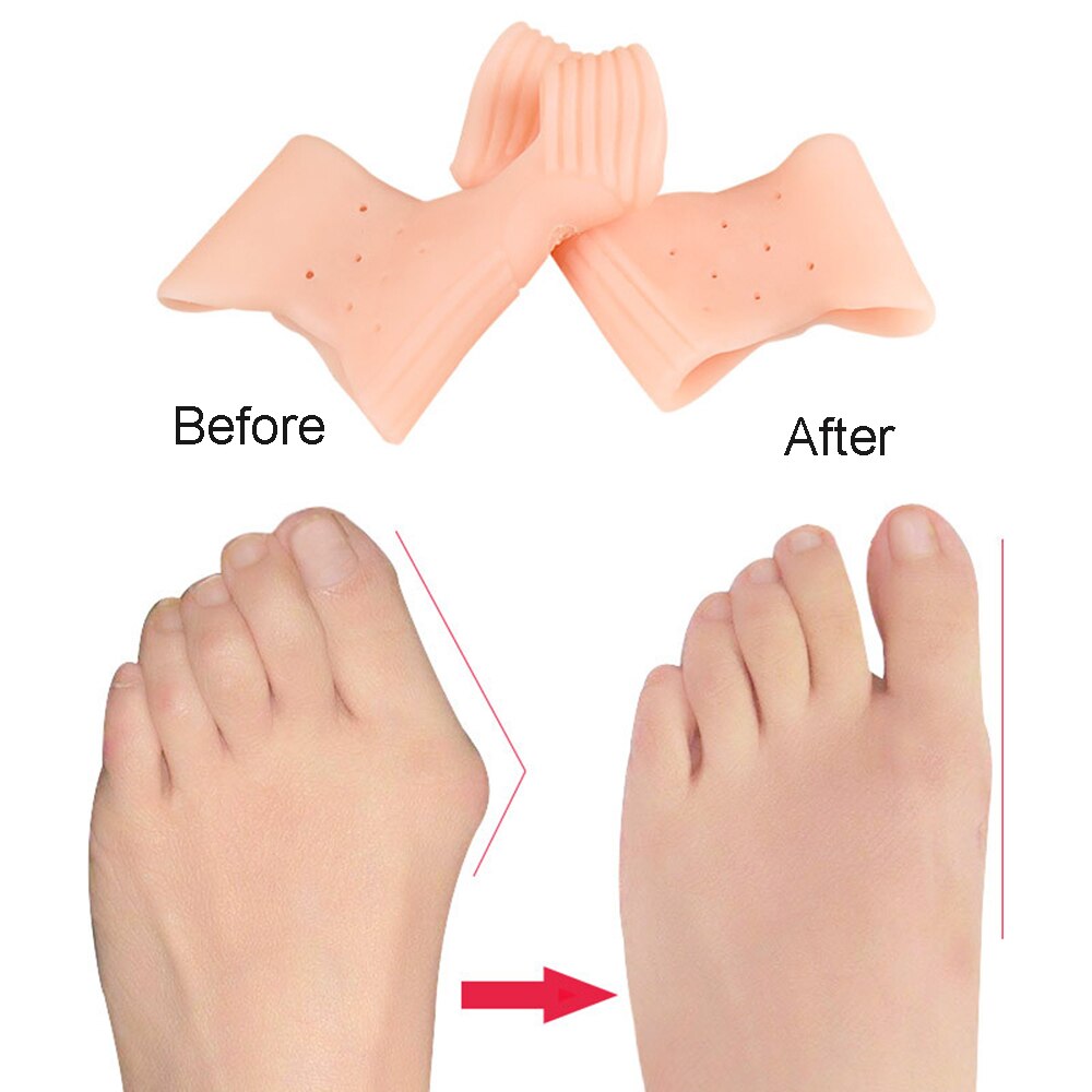 Separador de dedos de los pies, plantillas de silicona para aliviar el dolor, superpuestas, Protector de pies, órtesis, 2 uds.