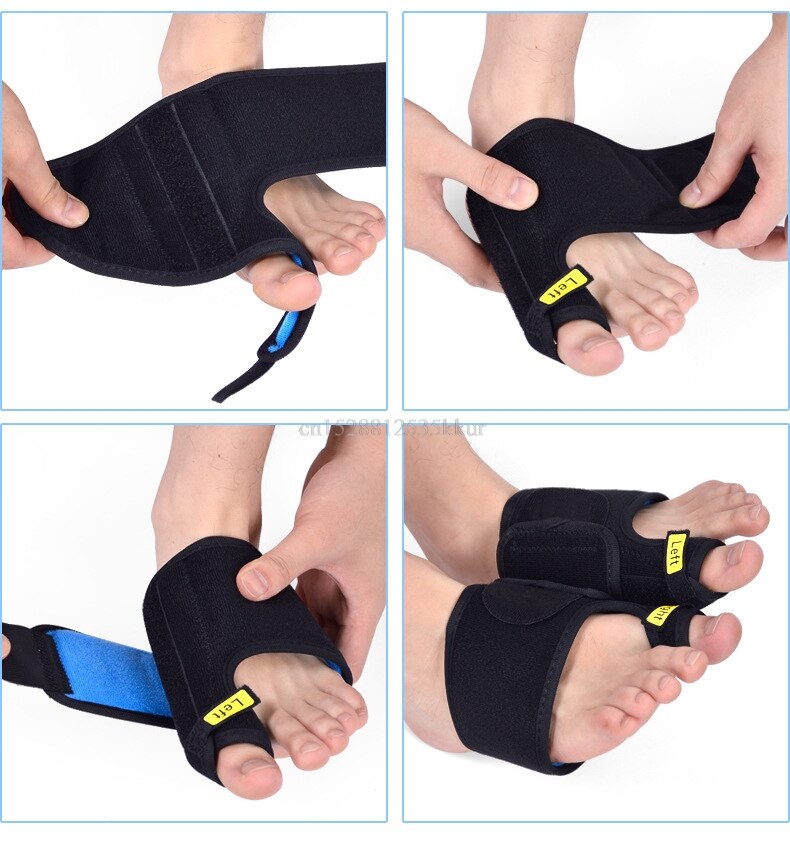 1Pcs Hallux Valgus Pro Teen Correctie Duim Tape Fysieke Pijnbestrijding Grote Bot Teen Corrector Magnetische Riem