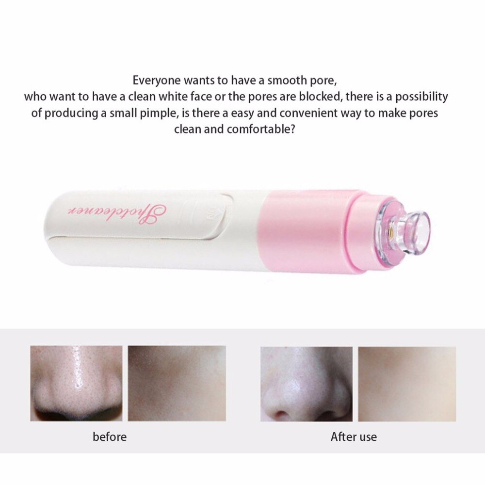 Electric Blackhead Vacuum Suction Facial Pore Spot Cleaner Face Dirt Suck Up Vacuum Acne Pimple Remover Beauty Skin Care Tool