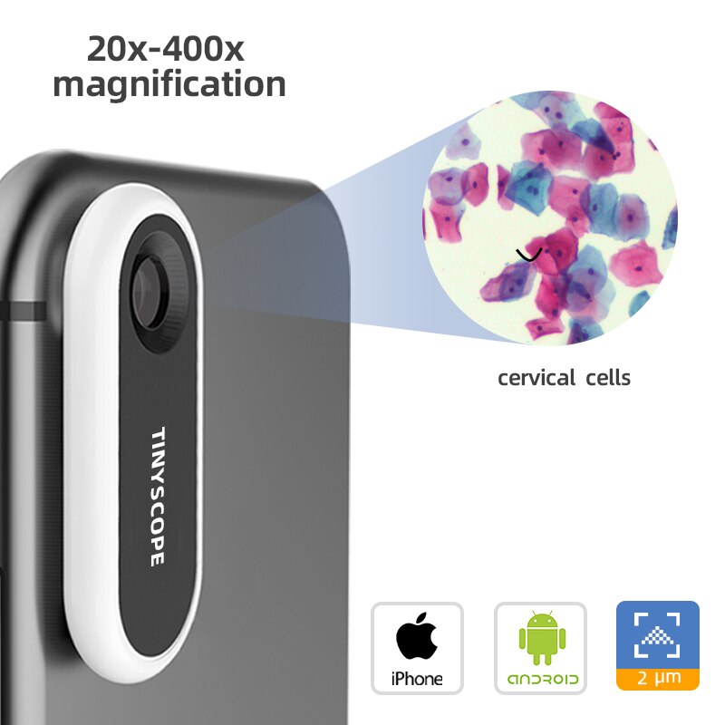 Portable microscope TinyScope pocket mobile microscope lens suitable for all smartphones 20x-400x magnification educational toy