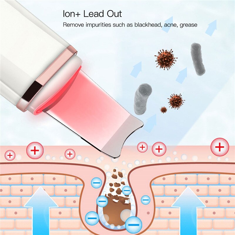 Ultraschall Ionen Gesicht Wäscher USB ems Mikrostrom Haut Reiniger Akne Auszieher Mitesser Toten Haut Schaber Vibrierende Peeling