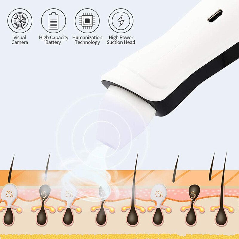 Nettoyeur de points noirs visuel USB Rechargeable Pores du visage nettoyeur de tête noire aspirateur 500X WiFi Microscope caméra 3 tête d'aspiration