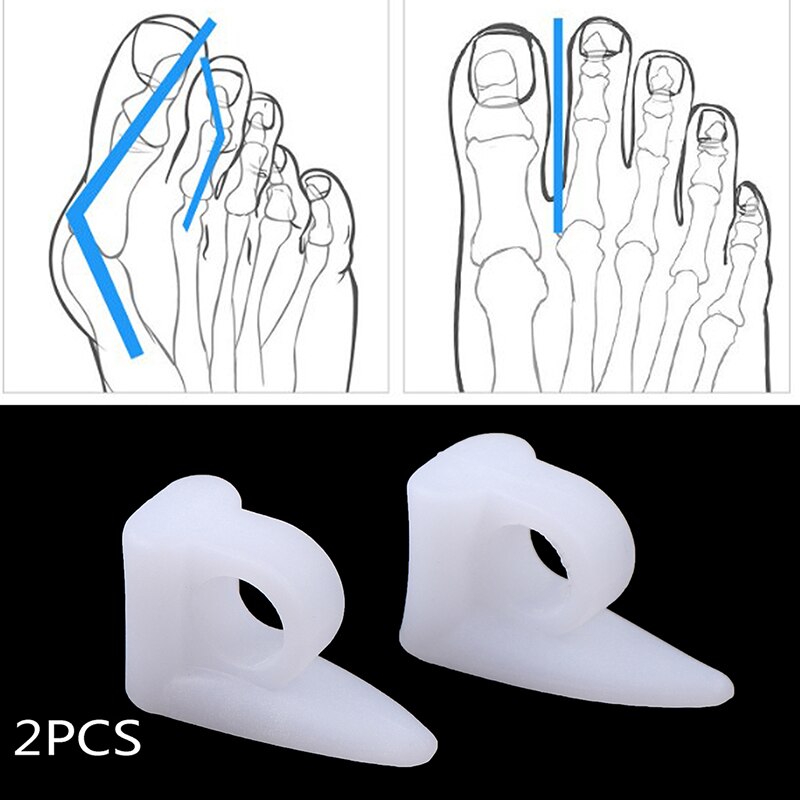 2Pcs Siliconen Gel Pad Straighteners Bunion Corrector Teen Pijn Protector Tenen Gel Pedicure Voetverzorging