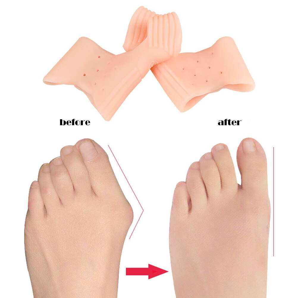 2Pcs Teen Separator Hallux Valgus Bunion Corrector Orthesen Voeten Bone Duim Richter Correctie Pedicure Sok Stijltang: Beige