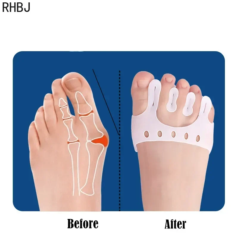 RHBJ 2 Stuks Siliconen Voorvoet Pads Pijnbestrijding Orthesen Teen Separator Anti-Slip Protector Schoenen Inlegzolen Kussen Voetverzorging gereedschap