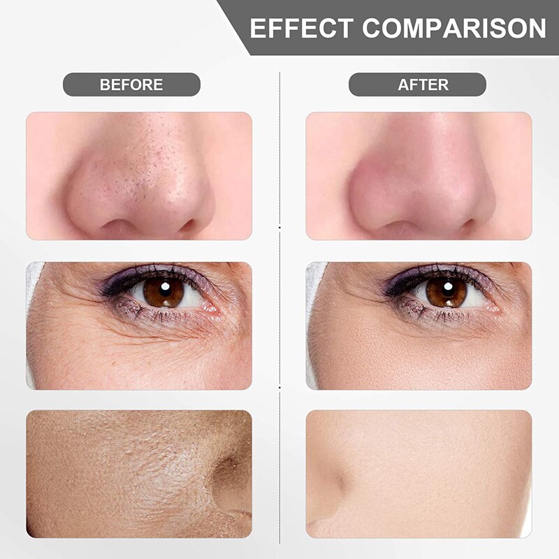 Ultrasone Huid Scrubber Diepe Gezicht Reinigingsmachine Peeling Schop Facial Pore Cleaner Gezicht Huid Scrubber Lifting Machine