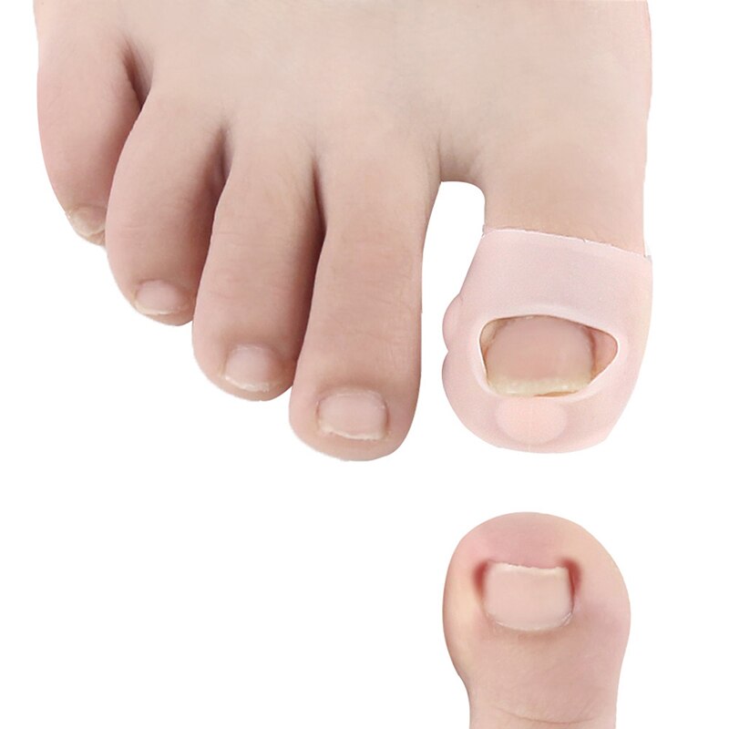 1 paar hallux valgus teenspreiders voetverzorgingstool silone stof hallux valgus correctie