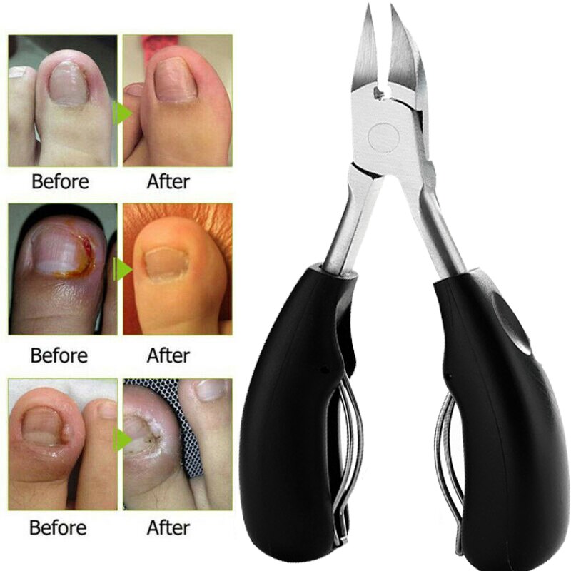 Toenail Clippers for Thick Ingrown Toe Nails Heavy Duty Precision Nail Scissor