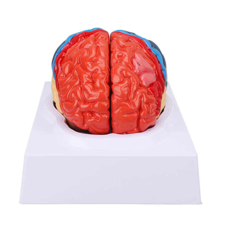 Anatomische Hersenen Gemonteerd Model Kleur Gepartitioneerd Human Brain Anatomisch Model Voor Onderwijs Gebruik