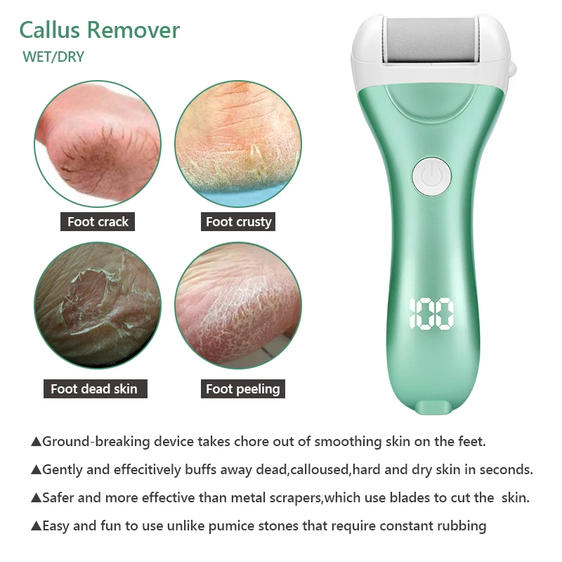 Elektrische Pedicure Voet Bestand USB Oplaadbare Power Display, 3 stks Slijpen Peeling Vervanging Hoofden Voor Hiel Eelt Remover