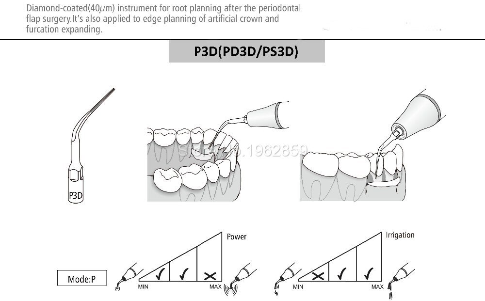 Escalador ultrasónico Dental P3D, puntas de escalado, ajuste EMS, pájaro carpintero, UDS, herramientas de punta de mano, 2 UDS.