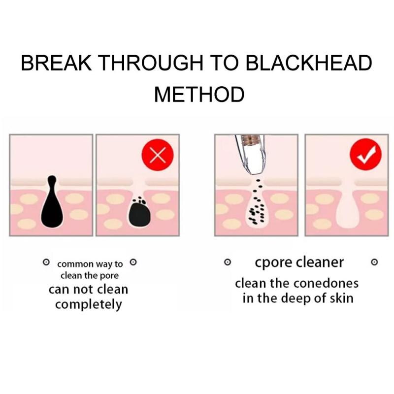 Blackhead Remover Skin Care Pore Vacuum Acne Removal Vacuum Suction Tool Facial Dermabrasion Machine Face Clean Blemish Removers