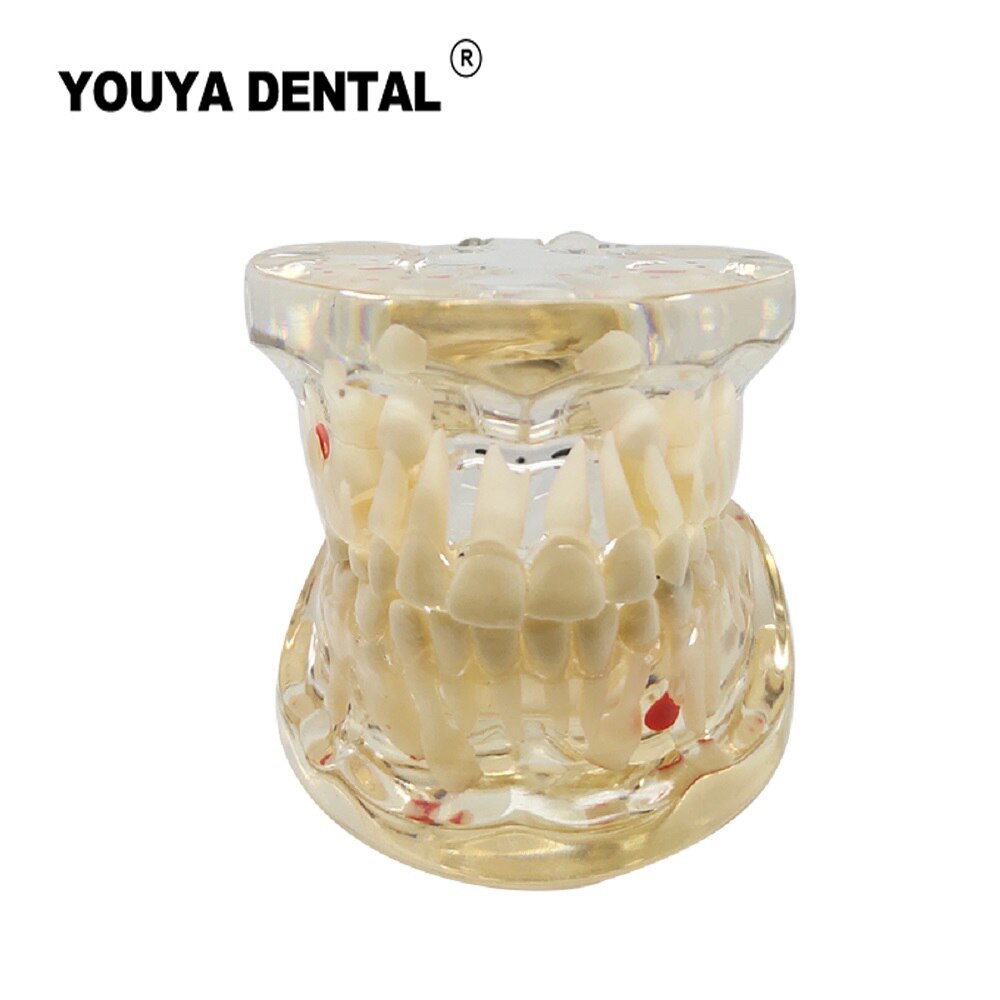 Dental Teaching Model Children Deciduous Tooth Permanent Teeth Alternating Study Pediatric Dental Pathology Preventive Model