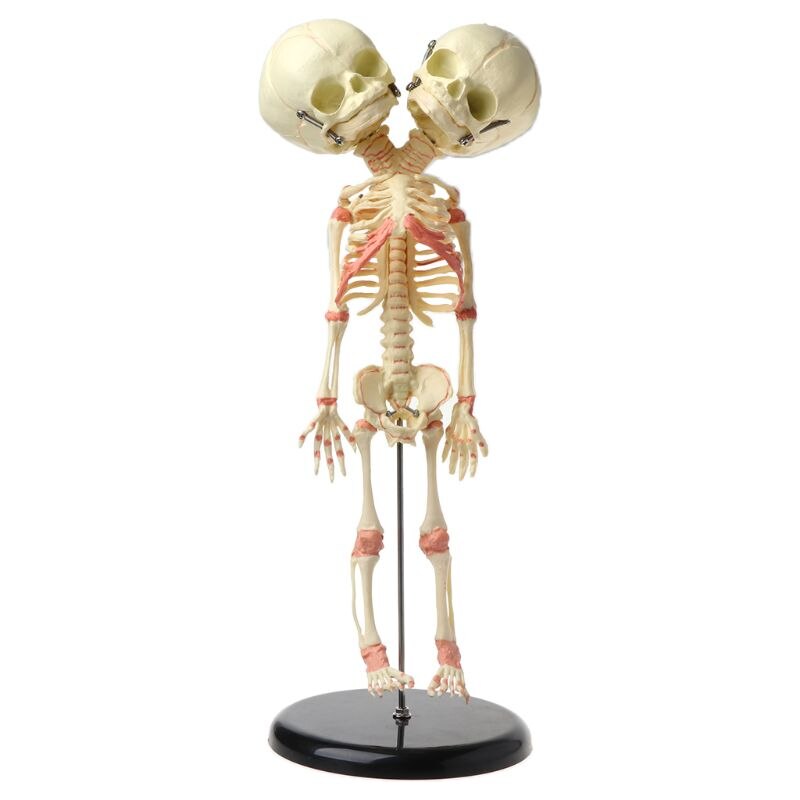 37cm Human Double Head Baby Skull Skeleton Anatomy Brain Display Study Teaching Anatomical Model