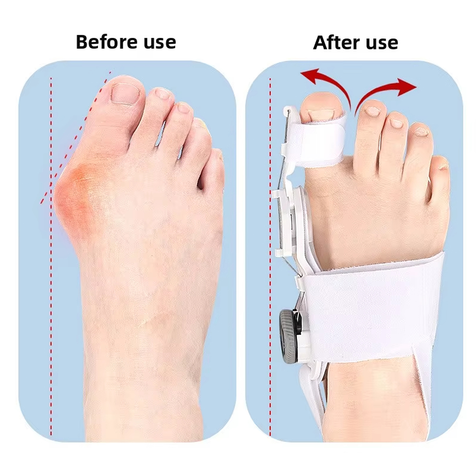 Bunion Corrector voor dames en heren, orthopedische bunionspalk met teenscheider Verstelbare teenstijltang Geschikt voor links/rechts