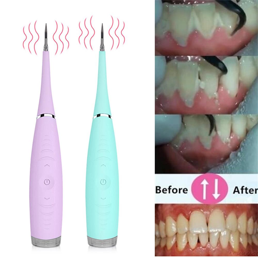 USB Electric Ultrasonic Sonic Dental Scaler Tooth Calculus Remover Cleaner Tooth Stains Tartar Tool Whiten Teeth Tartar Remove