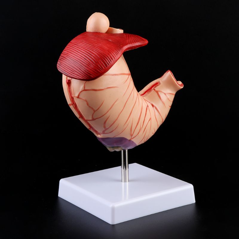 Human Anatomical Anatomy Stomach Model Gastric Pathology Gastritis Ulcer Teaching Learning Tool U4LD