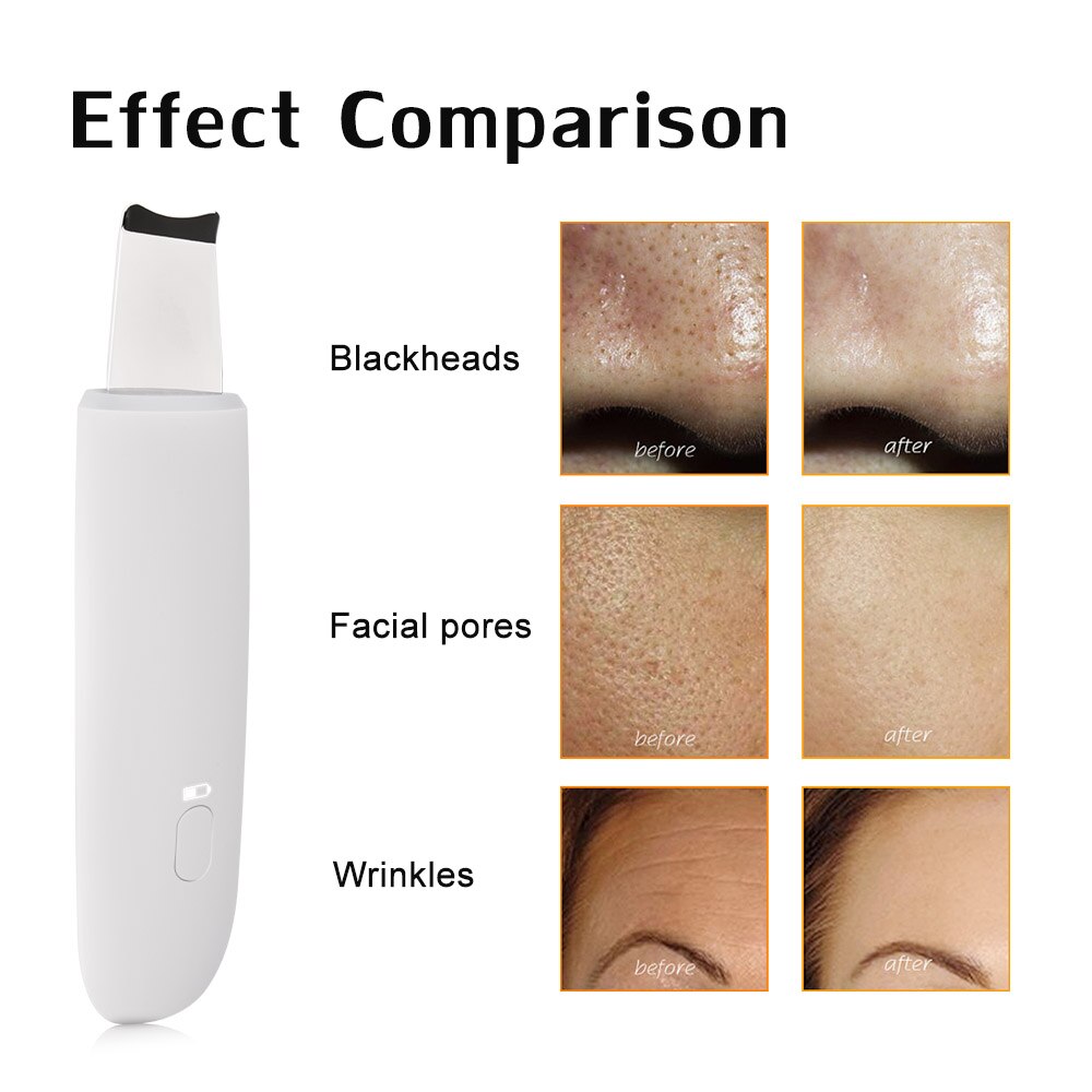 Cavitation Peeling Facial Cleaning Ultrasonic Skin Scrubber Deep Clean Ultrasonic Exfoliating Spa Scraper to Remove Blackheads