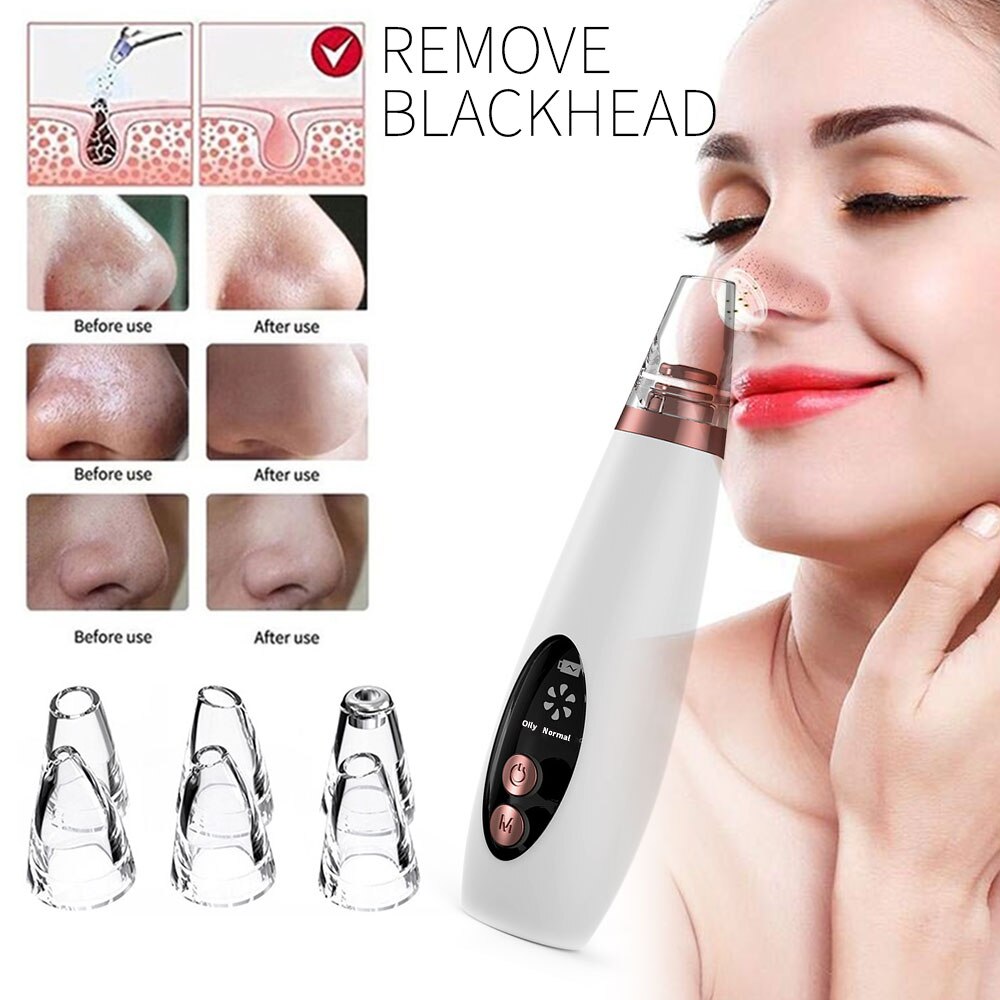 Comedondrukker Vacuüm Elektrische Facial Spa Zwart Hoofd Zuig Pore Cleaner Extractor Tool 6 Vervangbare Zuigkoppen