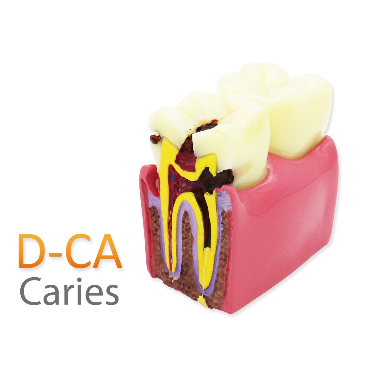 Modèle Dentaire 32 Dents ADC – Gingives Souples, Magnétique | Compatible Columbia 860