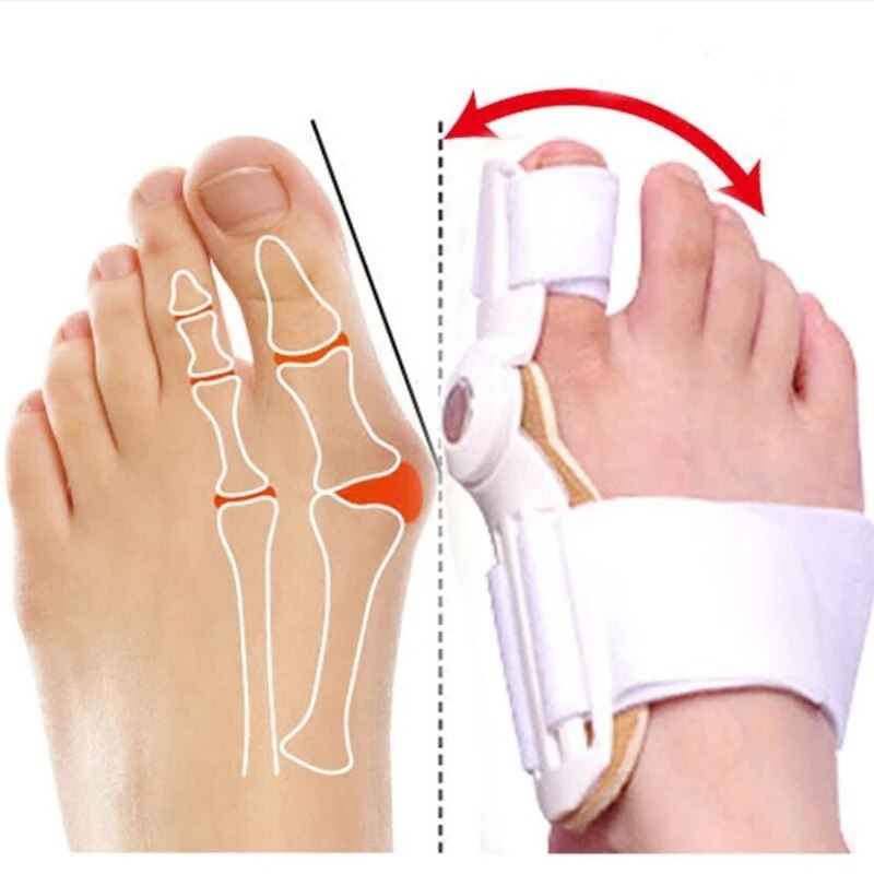 1pc store knogle tå knyst skinne glattejern korrektur tå separator tåbeskytter aflastning hallux valgus begge venstre højre fødder brugt