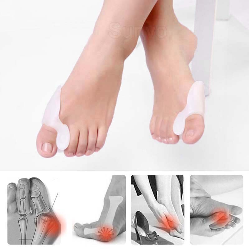 1 Paar Siliconen Teen Separator Bunion Spalk Grote Teen Bone Hallux Valgus Overlappende Corrector Schoen Insert Voetverzorging Orthese Gereedschap