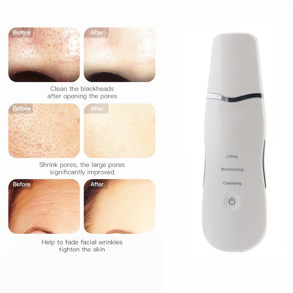 Ultrasonic Face Pore Cleaner Skin Scrubber Deeply Clean Blackhead Acne Removal Face Peeling Machine Skin beauty Instrument