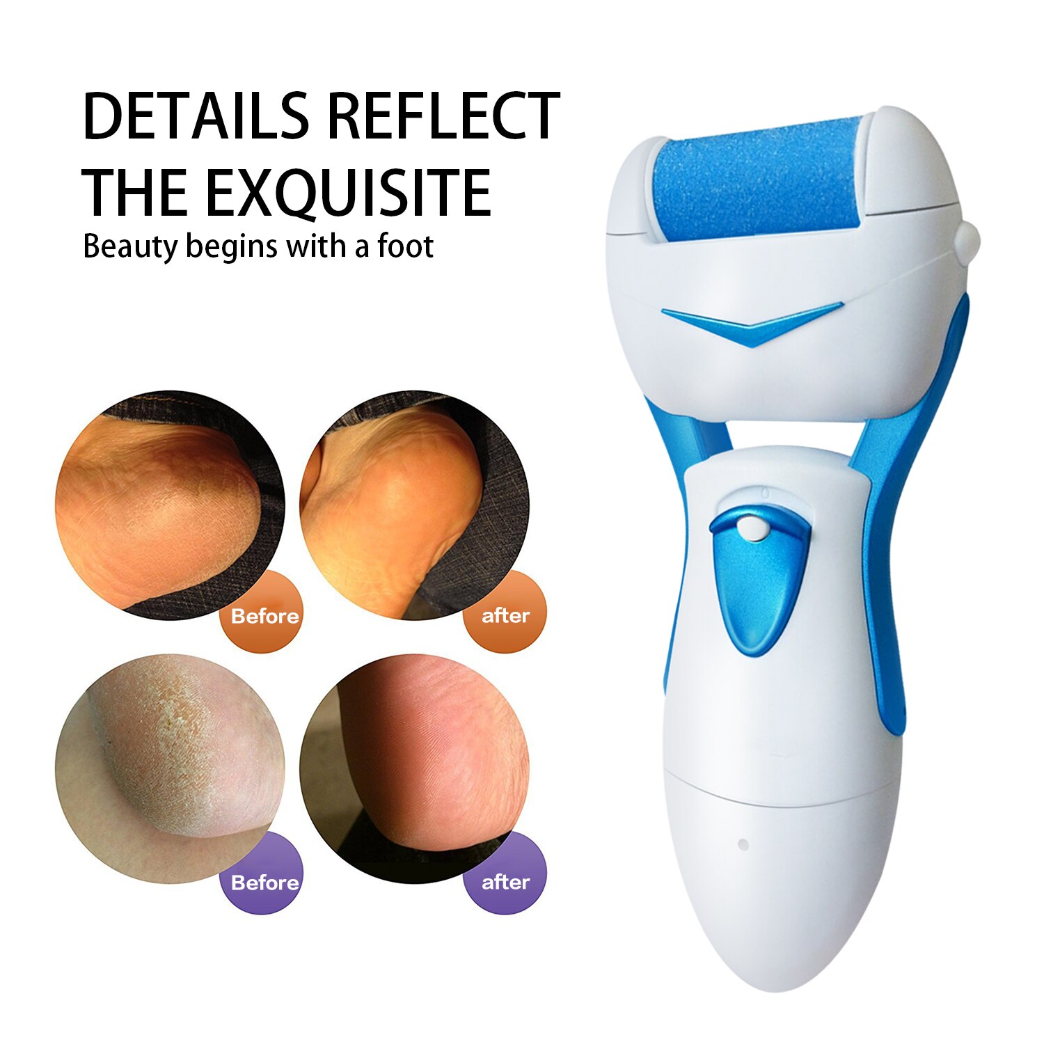 Lima eléctrica para pies de costura, herramienta roja para el cuidado de los pies, máquina de pedicura, rodillo para pelar la piel, Lima removedora de callos para Talón de hombre, novedad