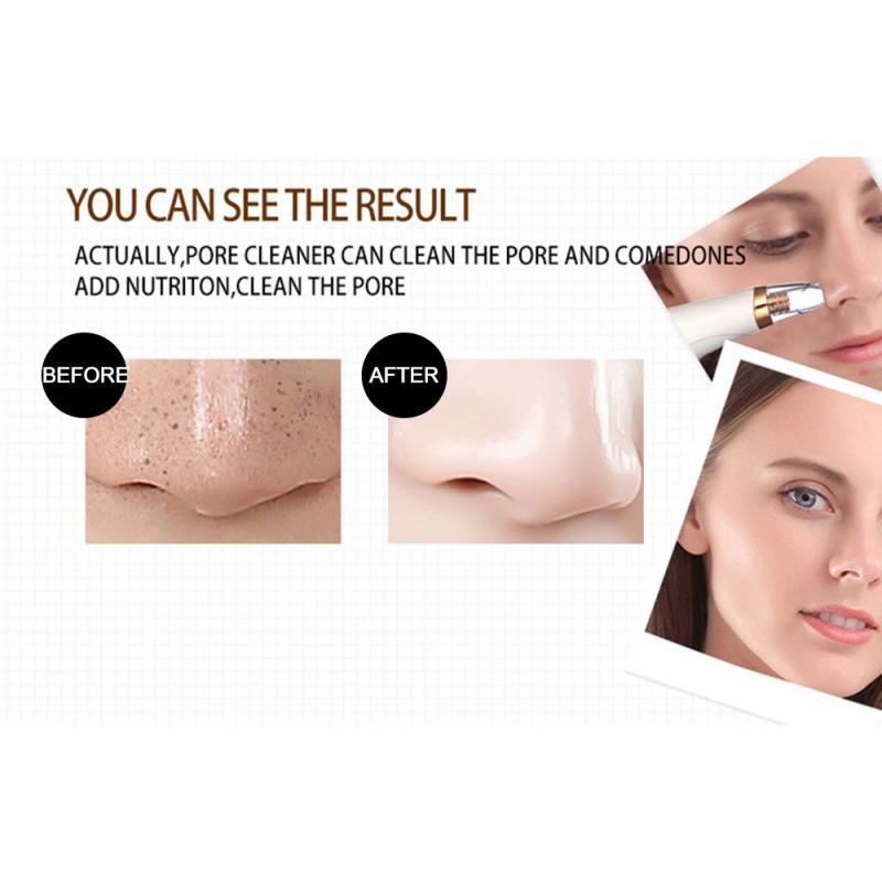 Electric Blackhead Remover Face Deep Pore Cleaner Acne Vacuum Cleaner Black Dot Blackhead Remover Skin Care Tools