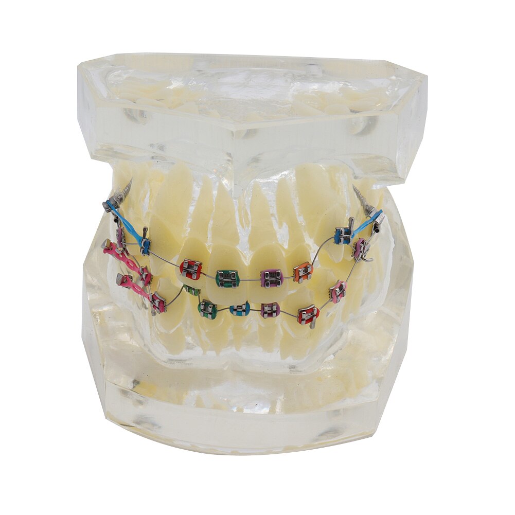 Modèle de dents Standard, modèle de dents orthodontiques avec supports et Tubes buccaux et Implant de fil de ligament et modèle de restauration: Model Transparent