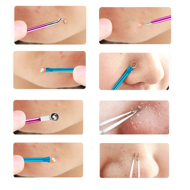 Acne Nose Blackhead Remover White Head Tool Pimple Removal Needle
