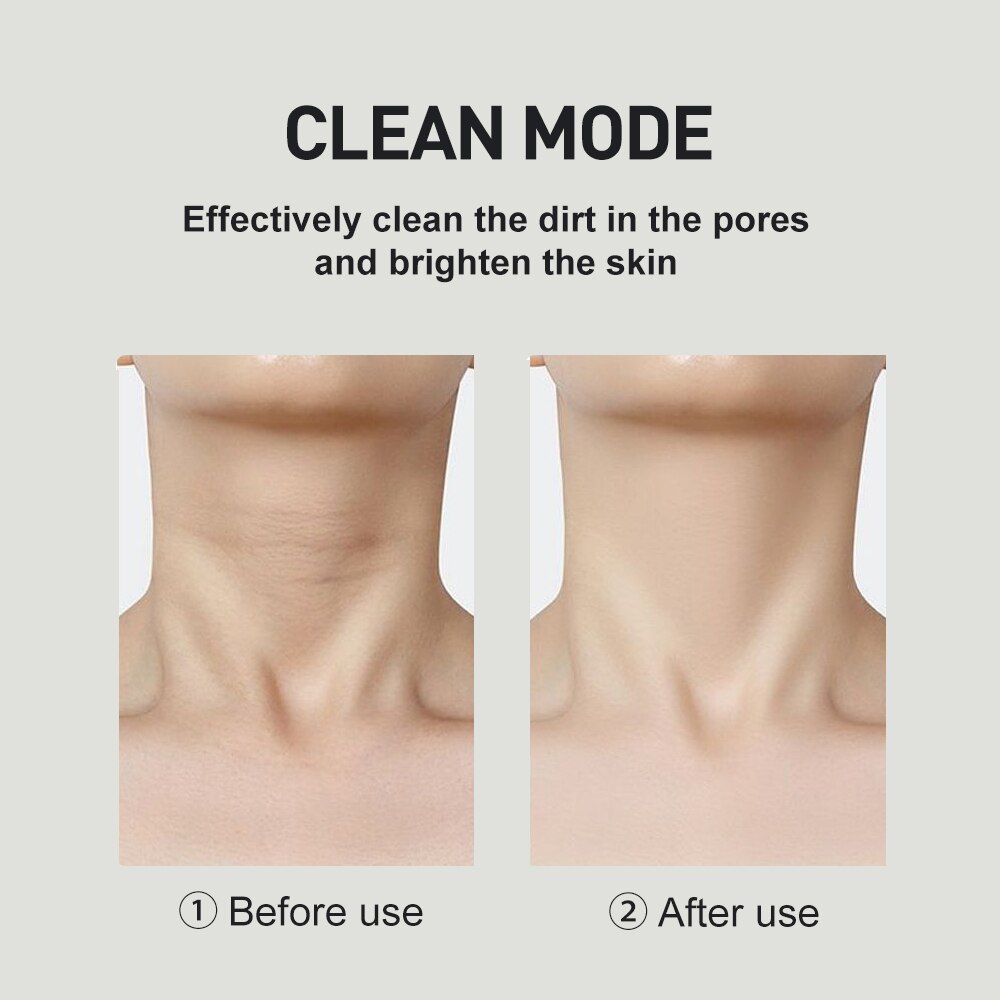 Terapia de fotones LED para cuello y herramienta para un levantamiento de rostro, vibración IPL, Reduce la piel, doble barbilla, dispositivo antiarrugas, 3 colores