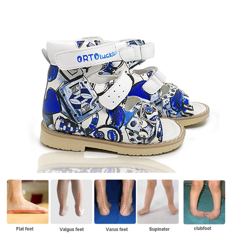 Ortoluckland kleinkind jungen walking sandalen leder orthopädische schuhe für kinder kinder schnalle muster starre plattfuß schuhe