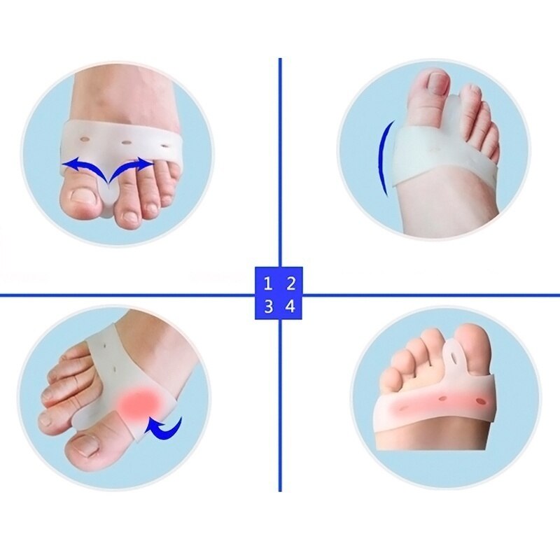 1 paar Siliconen Teen hallux valgus Scheidingsvellen Straighteners Bunion Relief Pads teen separator