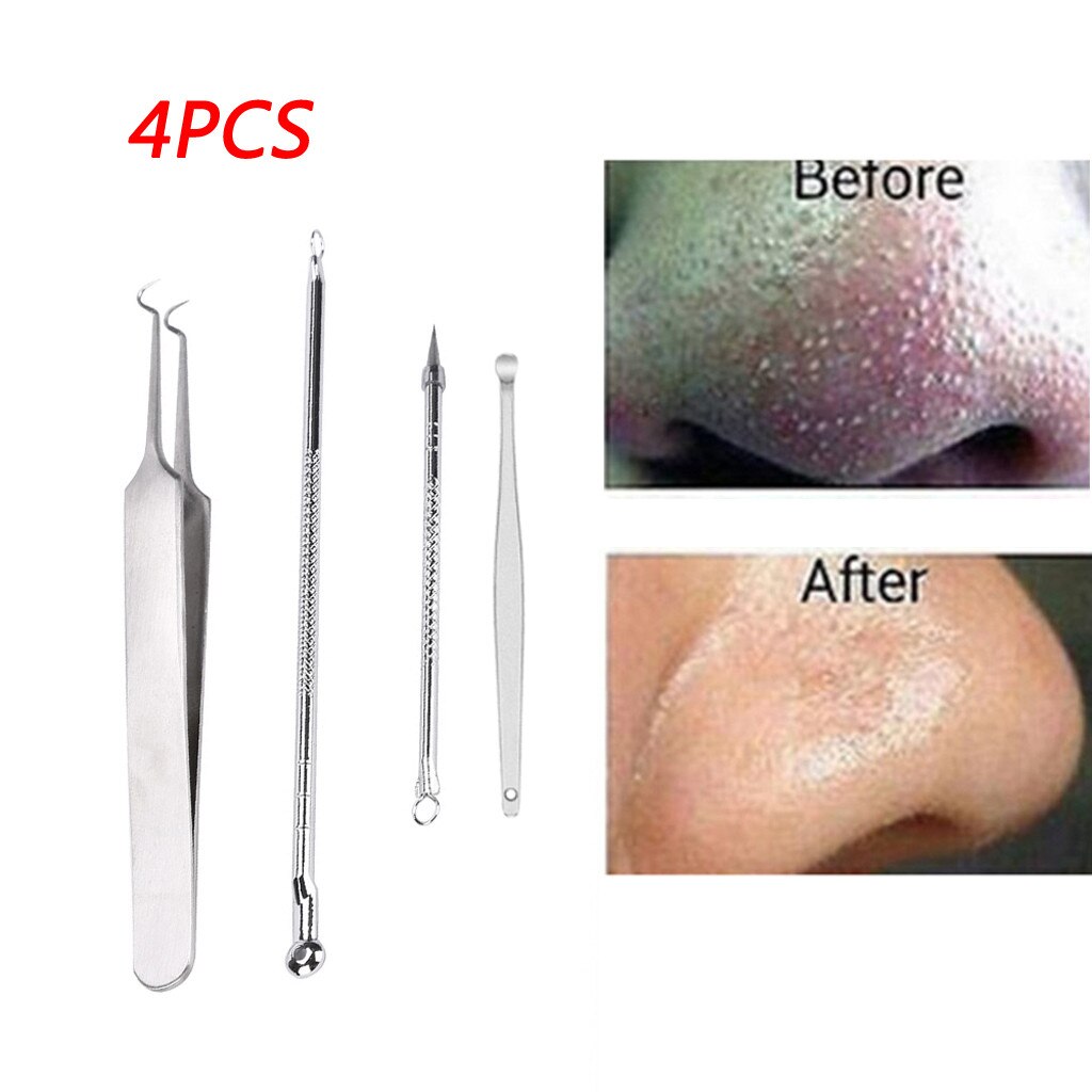 Beauty Tools Stainless Blackhead Facial Acne Spot Pimple Remover Ear Extractor Tool Comedone Mar.18