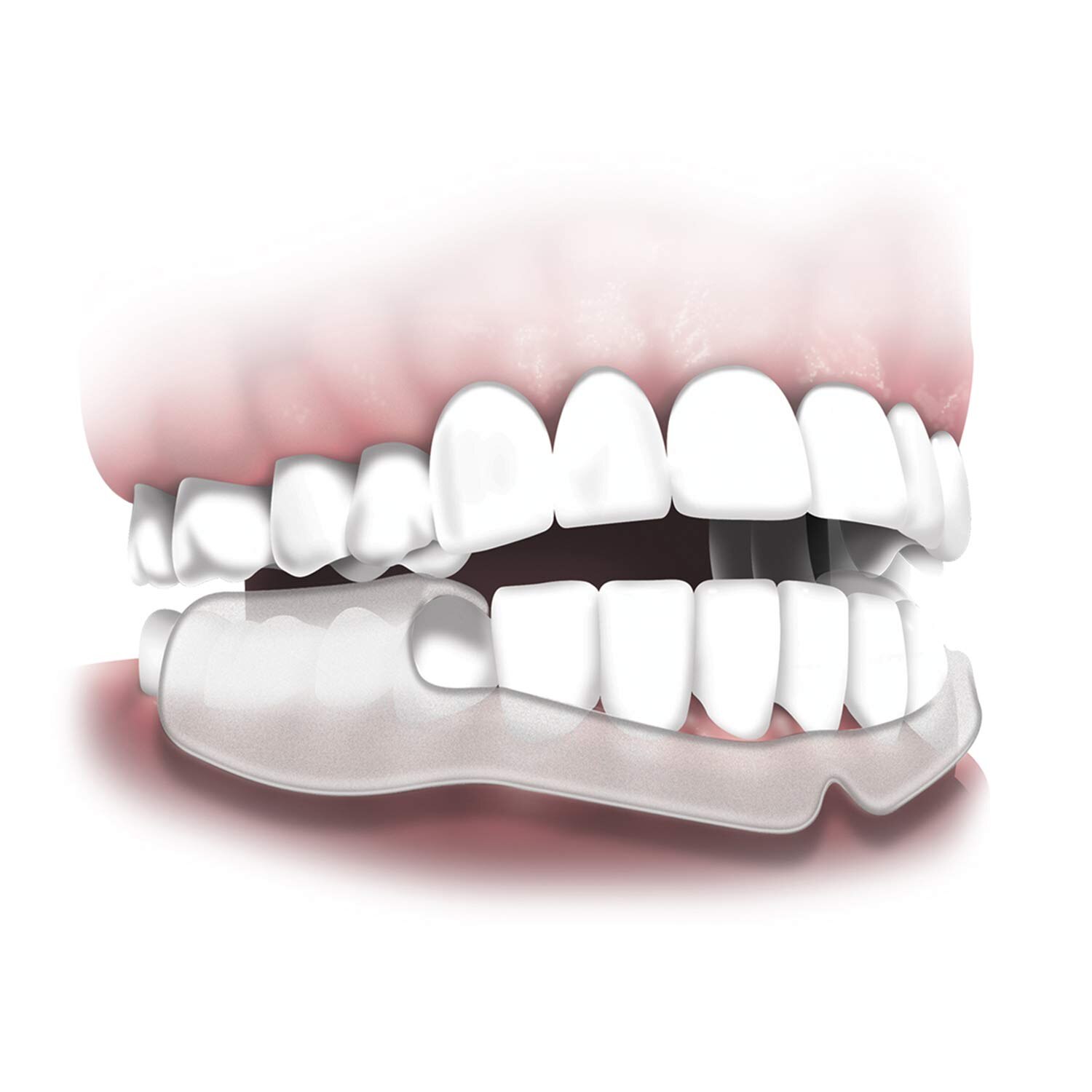 Silicone Mouth Guard Teeth Protector Night Guard Mouth Trays For Bruxism Grinding Anti-snoring Teeth Whitening Boxing Protection