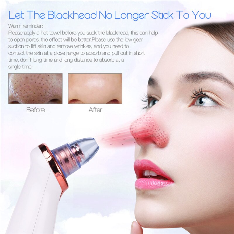 CkeyiN 5 in 1 Face Vacuum Suction Pore Cleaner Nose Blackhead Remover Acne Pimple Removal Household SPA Skin Care