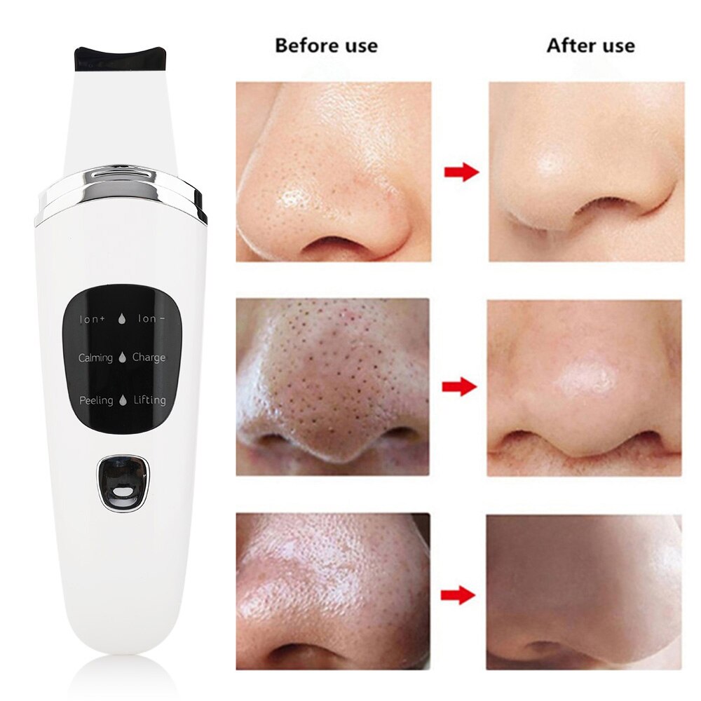 Ultrasonic Skin Scrubber Deep Face Cleaner Machine Dirt Blackhead Removal Facial Lifting Peeling Reduce Wrinkles Skin Scrubber