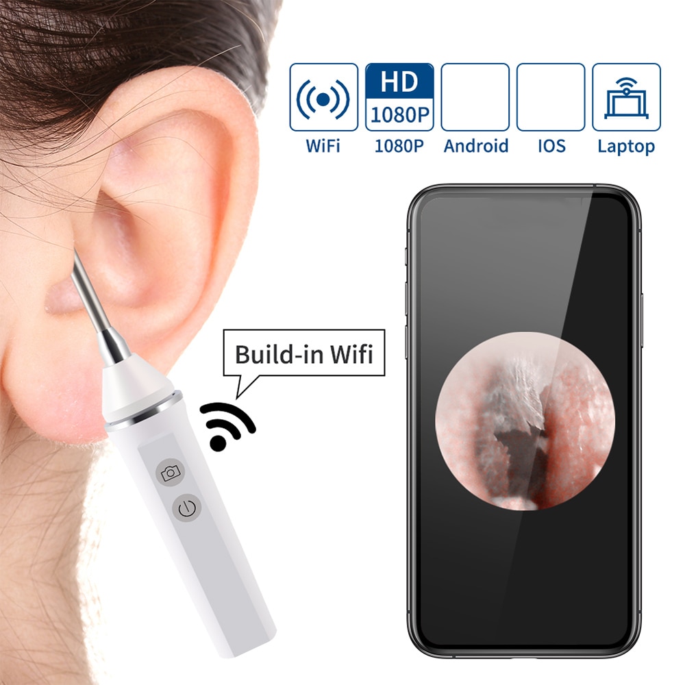 Mini Wifi Endoscoop Camera 3.9Mm 6 Leds Drie-In-een Interface Usb Inspectie Oor Neus Visuele Gezondheid zorg Met Oor Pick Set