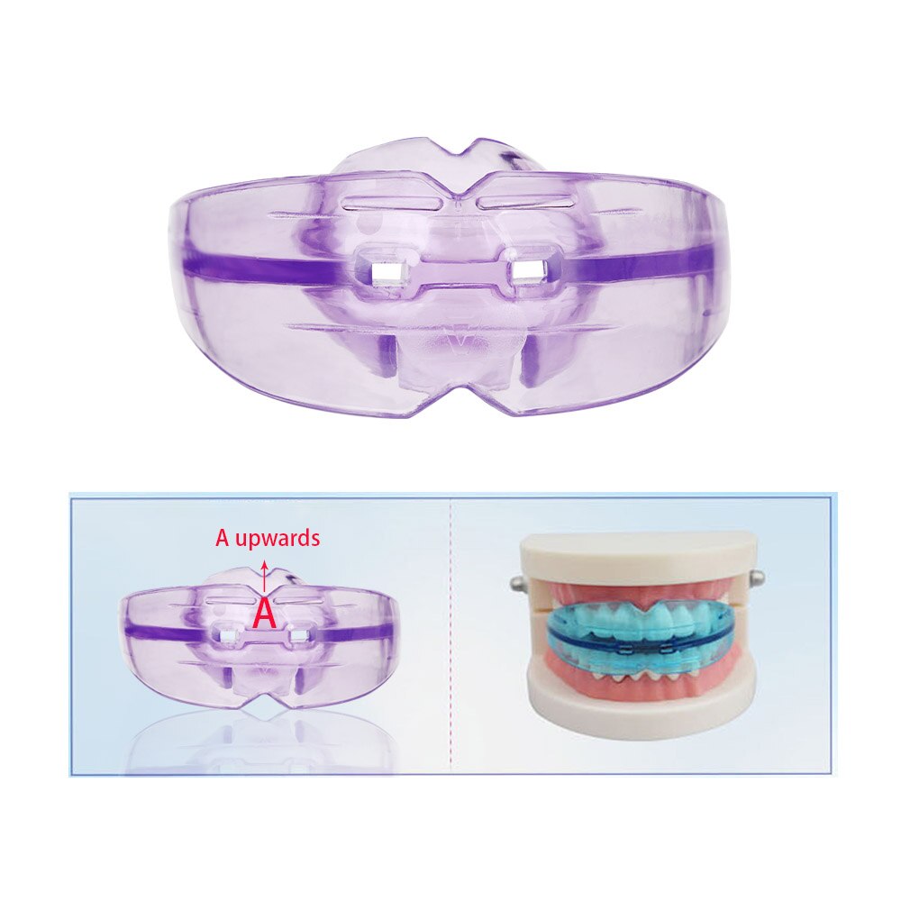 Orthodontic Braces Dental Braces Instanted Silicone Smile Teeth Alignment Trainer Teeth Retainer Mouth Guard Braces Tooth Tray