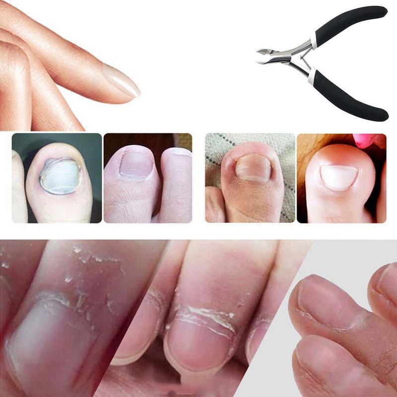 Precision Toenail Clippers Sharp Stainless Steel Nail Cutter Precision Stainless Steel Nail Clippers For Thick Ingrown Toenails