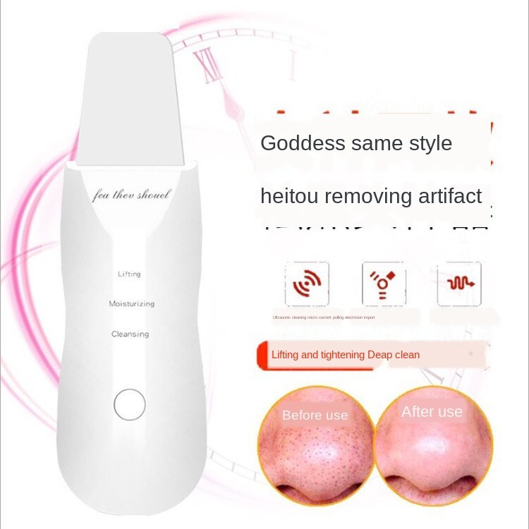 Anlan-purificador de pelo ultrassônico, máquina de limpieza provista de rosado, peeling facial, limpiador de poros, máquina de esfo