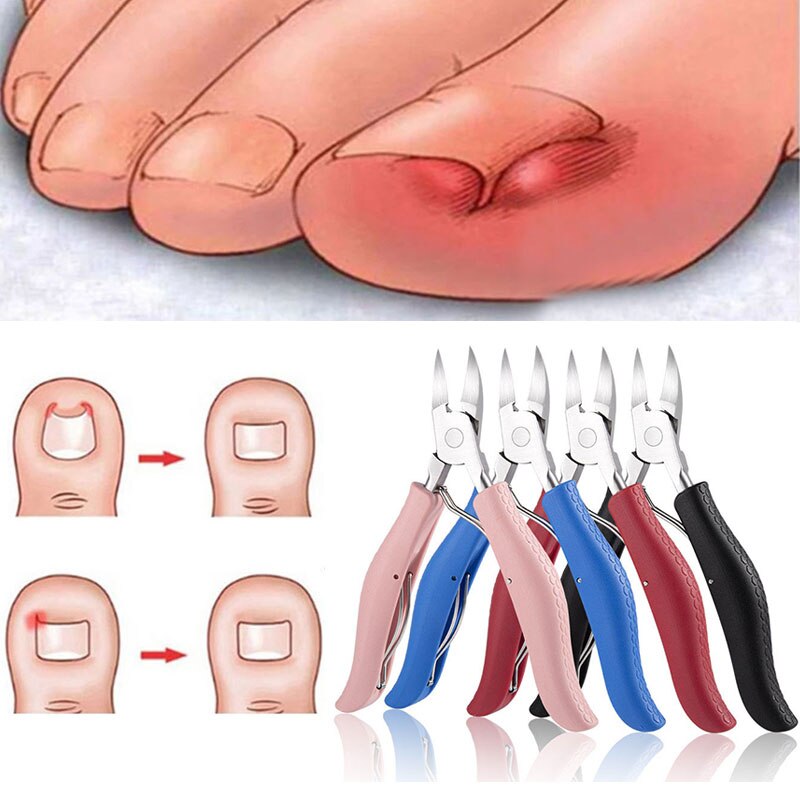 Tijeras para cutículas de uñas y uña del dedo del pie, producto para eliminar la piel muerta, herramienta de manicura y pedicura