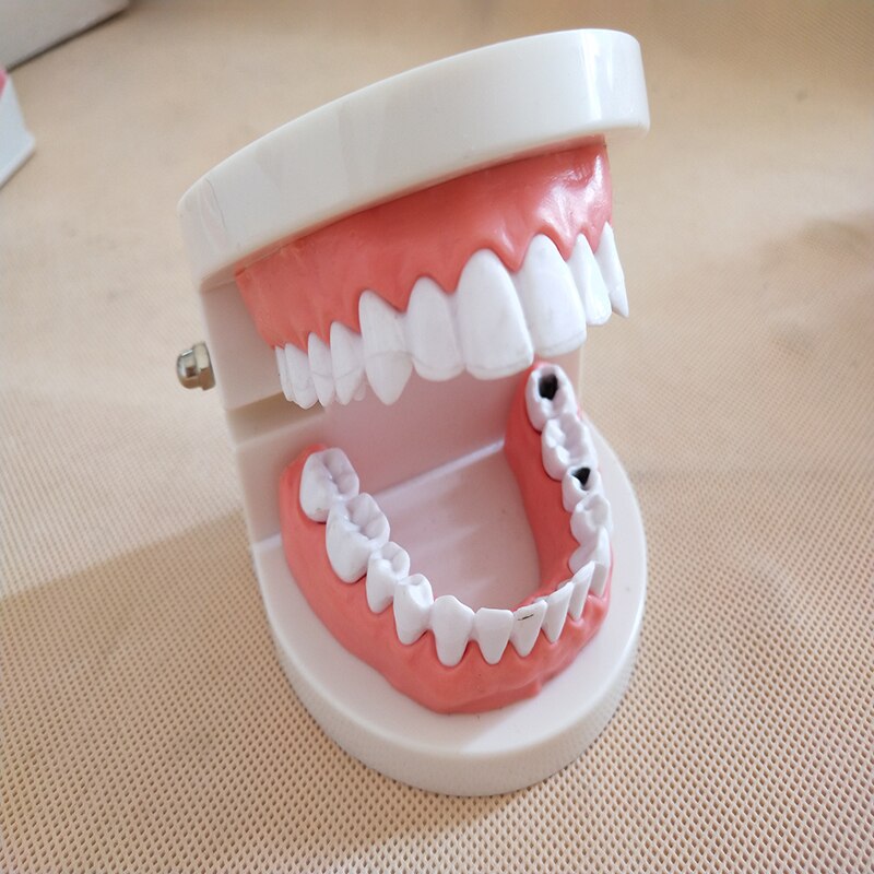 Dental Implant Teeth Model Teaching Study Model Dentist Resin Tooth Orthodontic Modeling For Student Practice