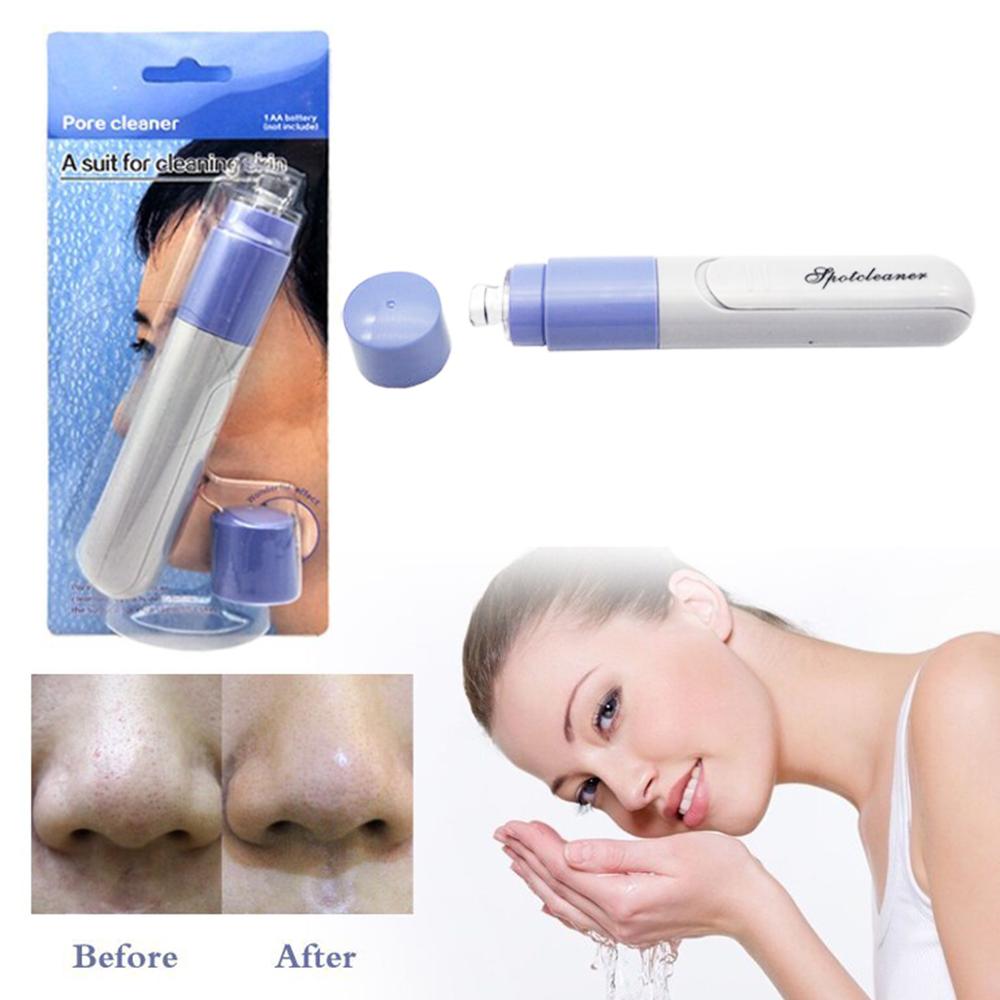 Electric Facial Pore Blackhead Cleaner Remover Vacuum Acne Microdermabrasion Facial Pore Cleanser Blackhead Suction Remover: Blue