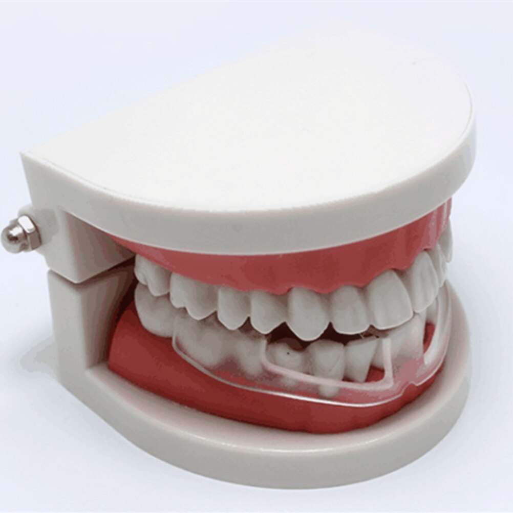 Professionele Tandheelkundige Night Guard Tanden Slijpen Protector Stopt Tandenknarsen Bruxisme Night Sleep Aid Gereedschap