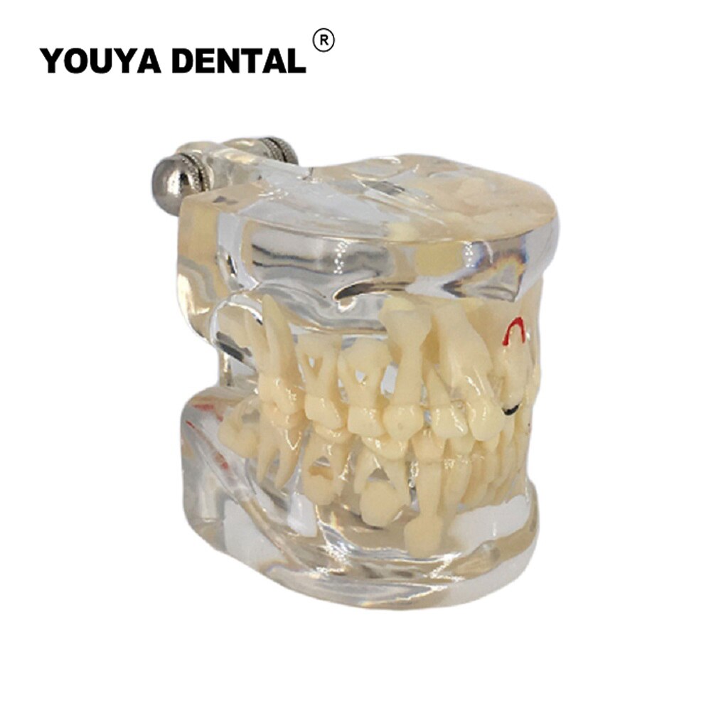 Dental Teaching Model Children Deciduous Tooth Permanent Teeth Alternating Study Pediatric Dental Pathology Preventive Model