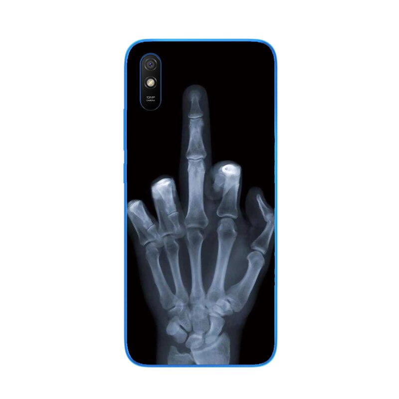 Para xiaomi redmi 9a caso silicone amortecedor macio tpu fundas caso de telefone para xiaomi redmi 9a redmi9a caso capa traseira escudo coque: 31