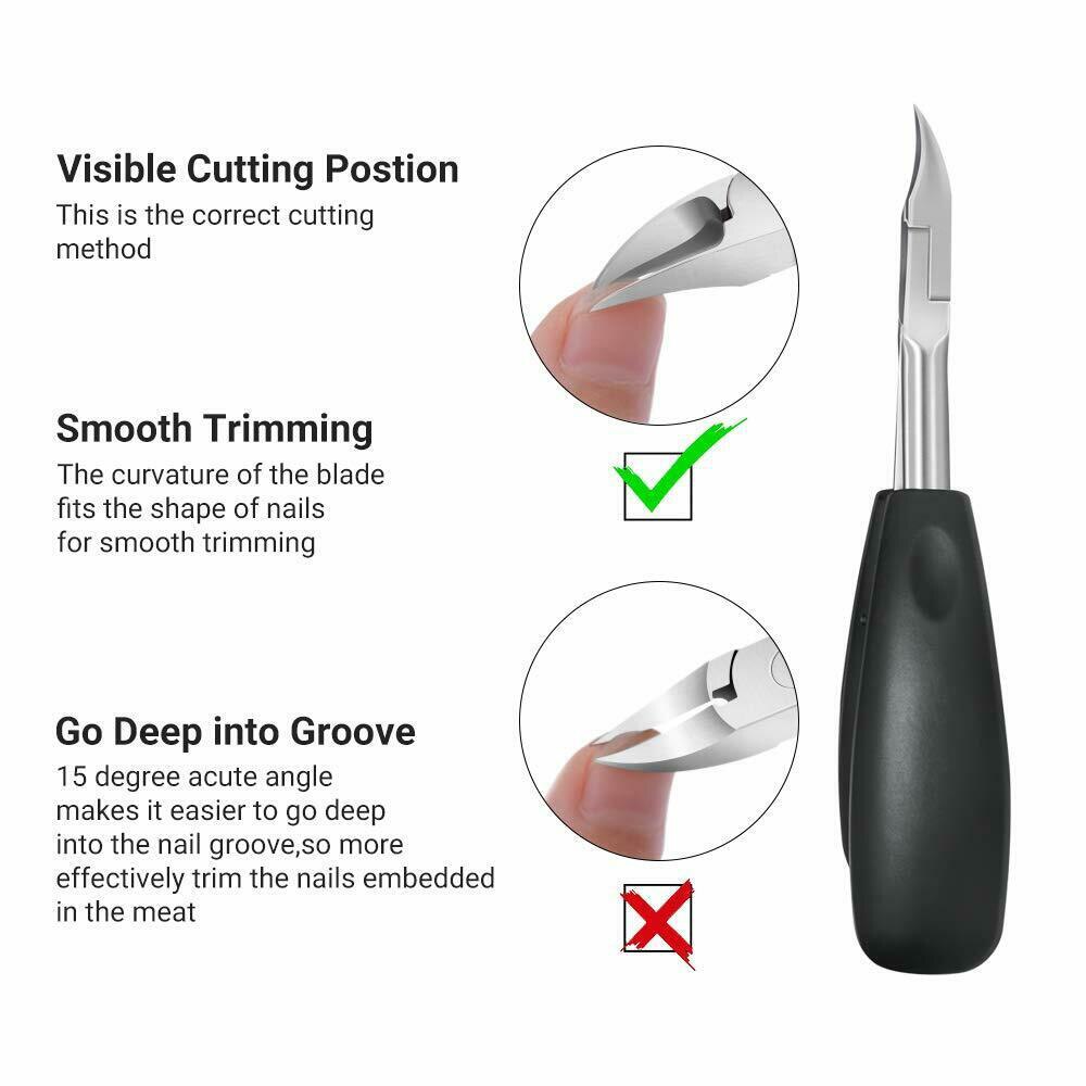 Grande pince Olecranon Paronychia spécial tondeuses enfants adulte acier inoxydable orteil coupe-ongles pédicure incarné ongles outils